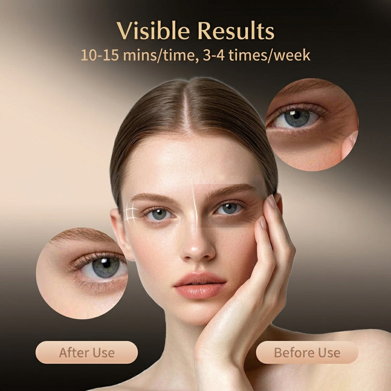 EysiGlowa Red Light Therapy For Eyes