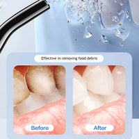 TonsiJet Water Flosser For Tonsil Stones