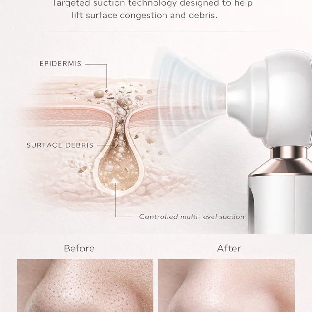 Acnixpia Blackhead Remover