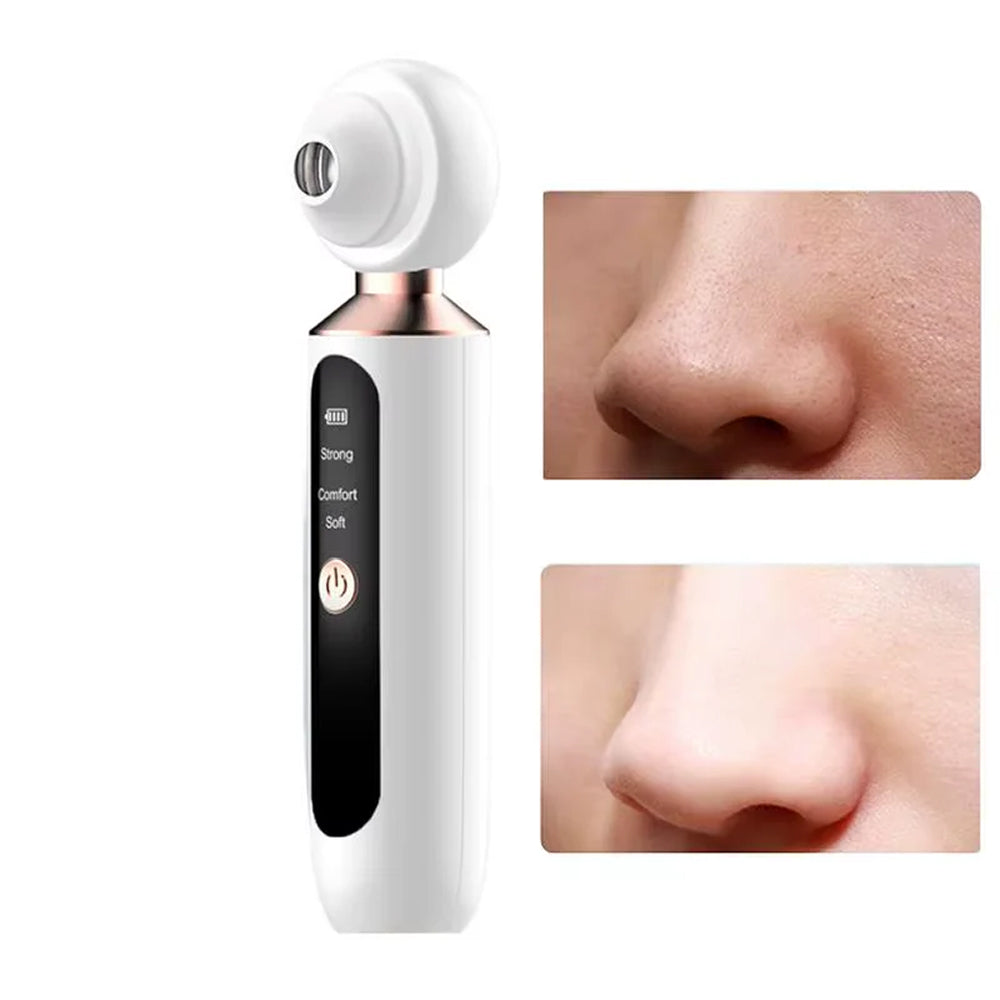 Acnixpia Blackhead Remover