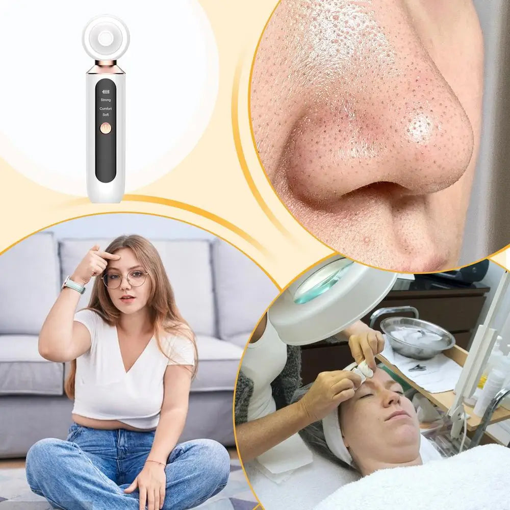 Acnixpia Blackhead Remover