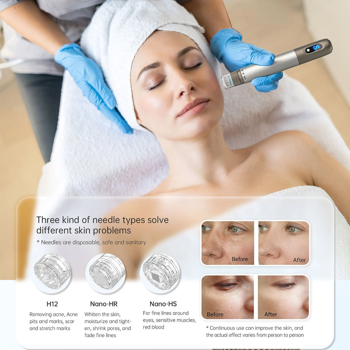 DermiPx Microneedling Pen