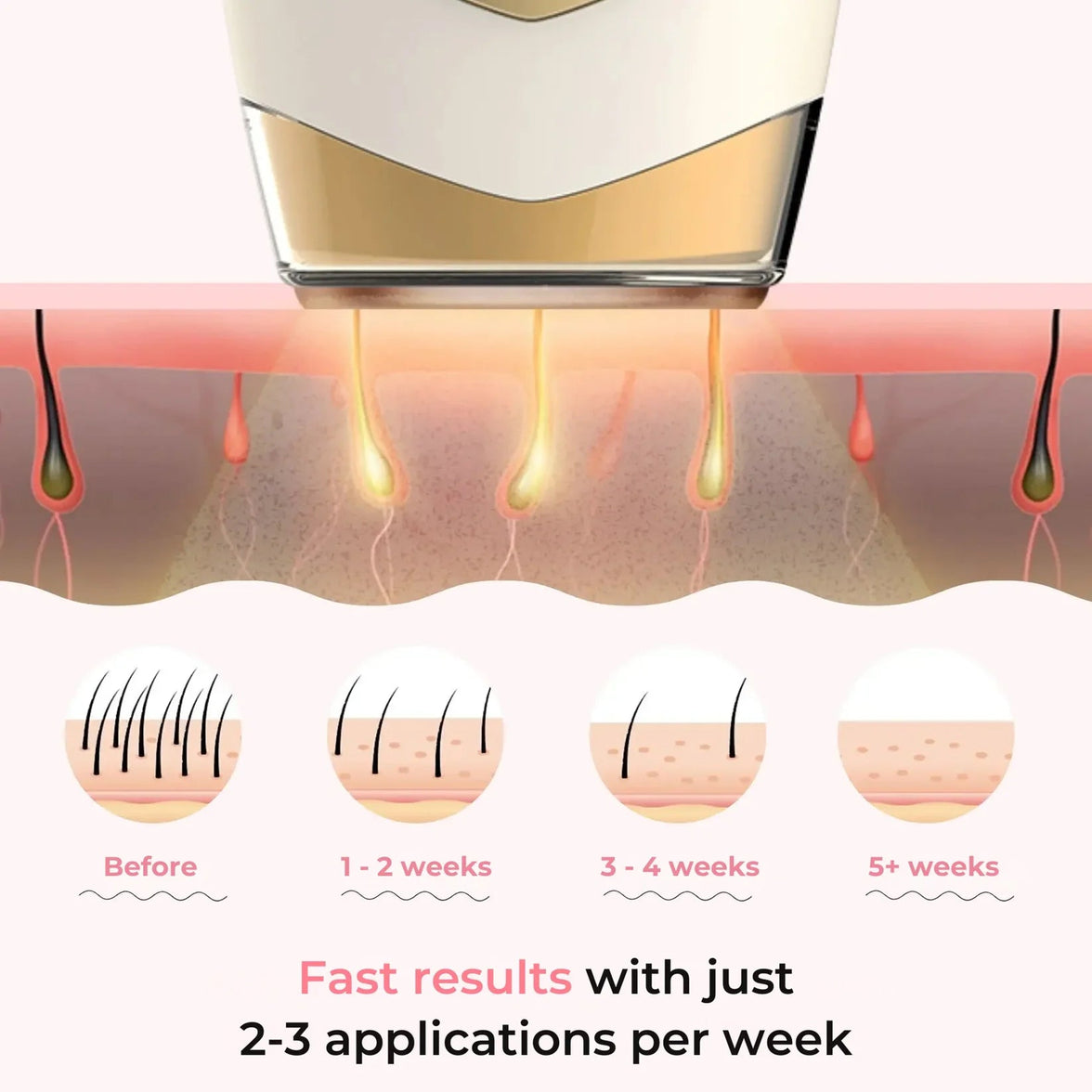 Glayzlix Laser Hair Removal