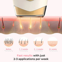 Glayzlix Laser Hair Removal