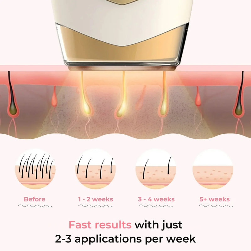 Glayzlix Laser Hair Removal