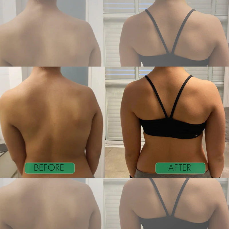 Postrixmer Hunchback Posture Corrector