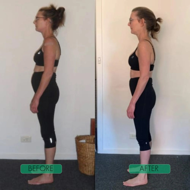 Postrixmer Hunchback Posture Corrector