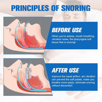 Quietmex Anti Snoring Mouthpiece