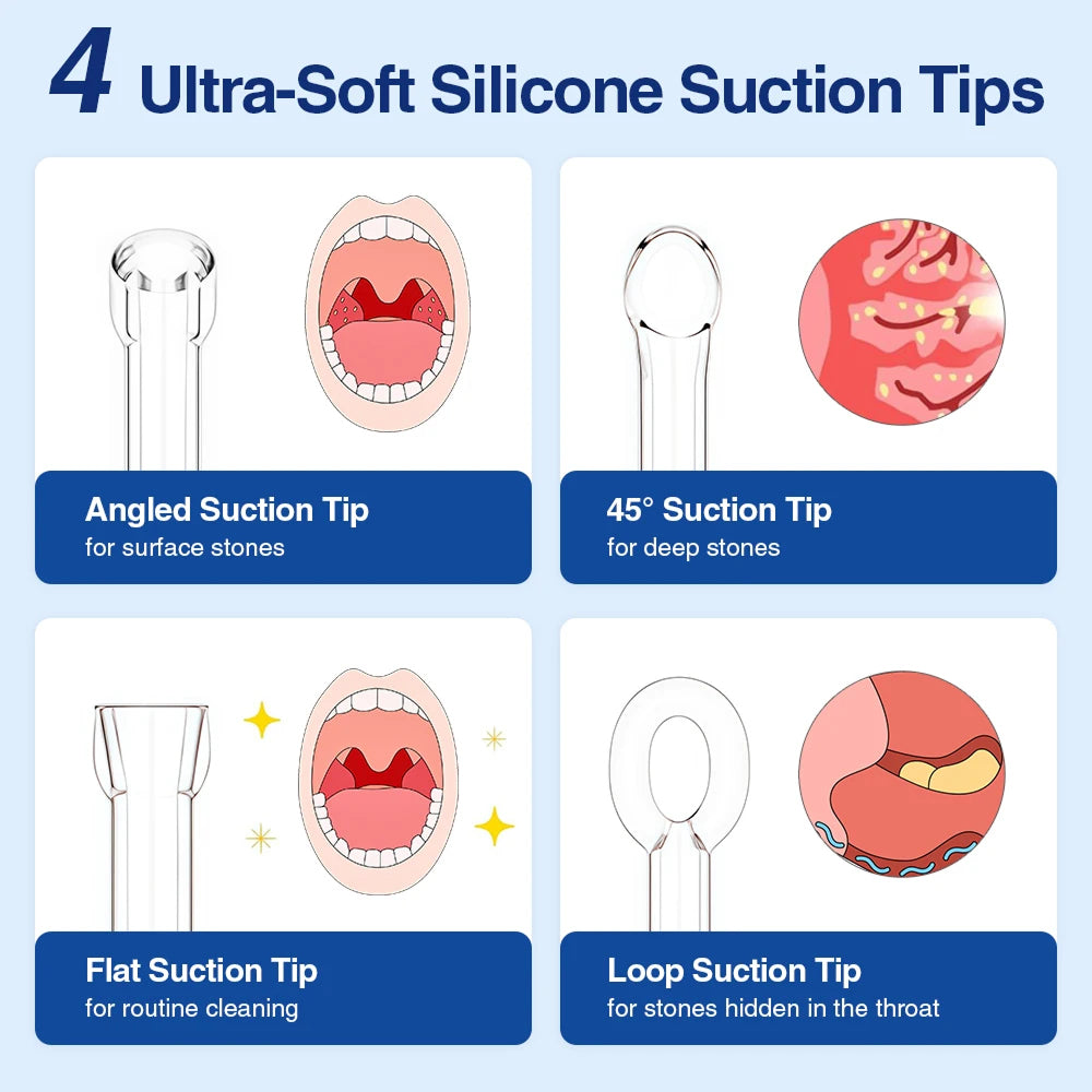 Tonsimox Tonsil Stone Remover