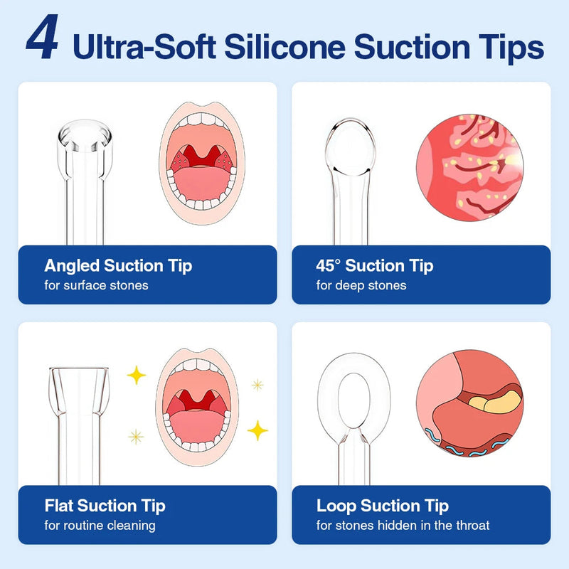 Tonsimox Tonsil Stone Remover